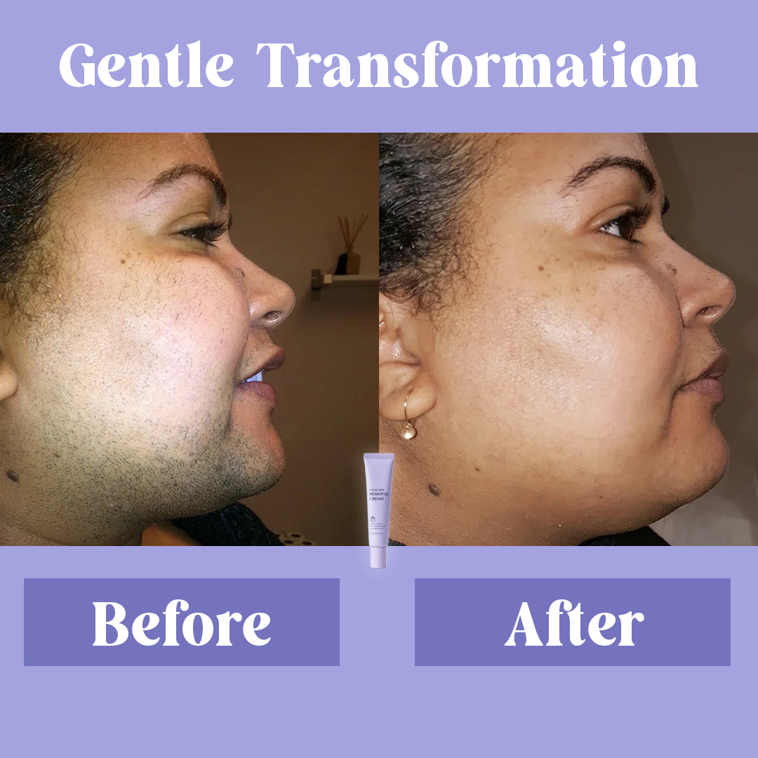SilkSkin™ Facial Hair Removal Cream