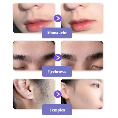 SilkSkin™ Facial Hair Removal Cream