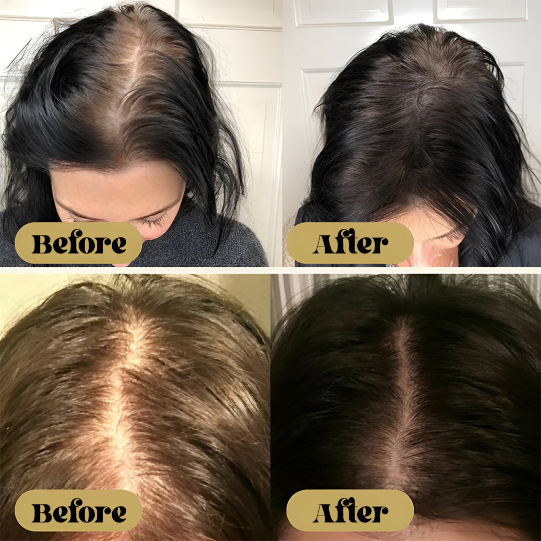 BareBloom™ Vegan Hair Growth Oil