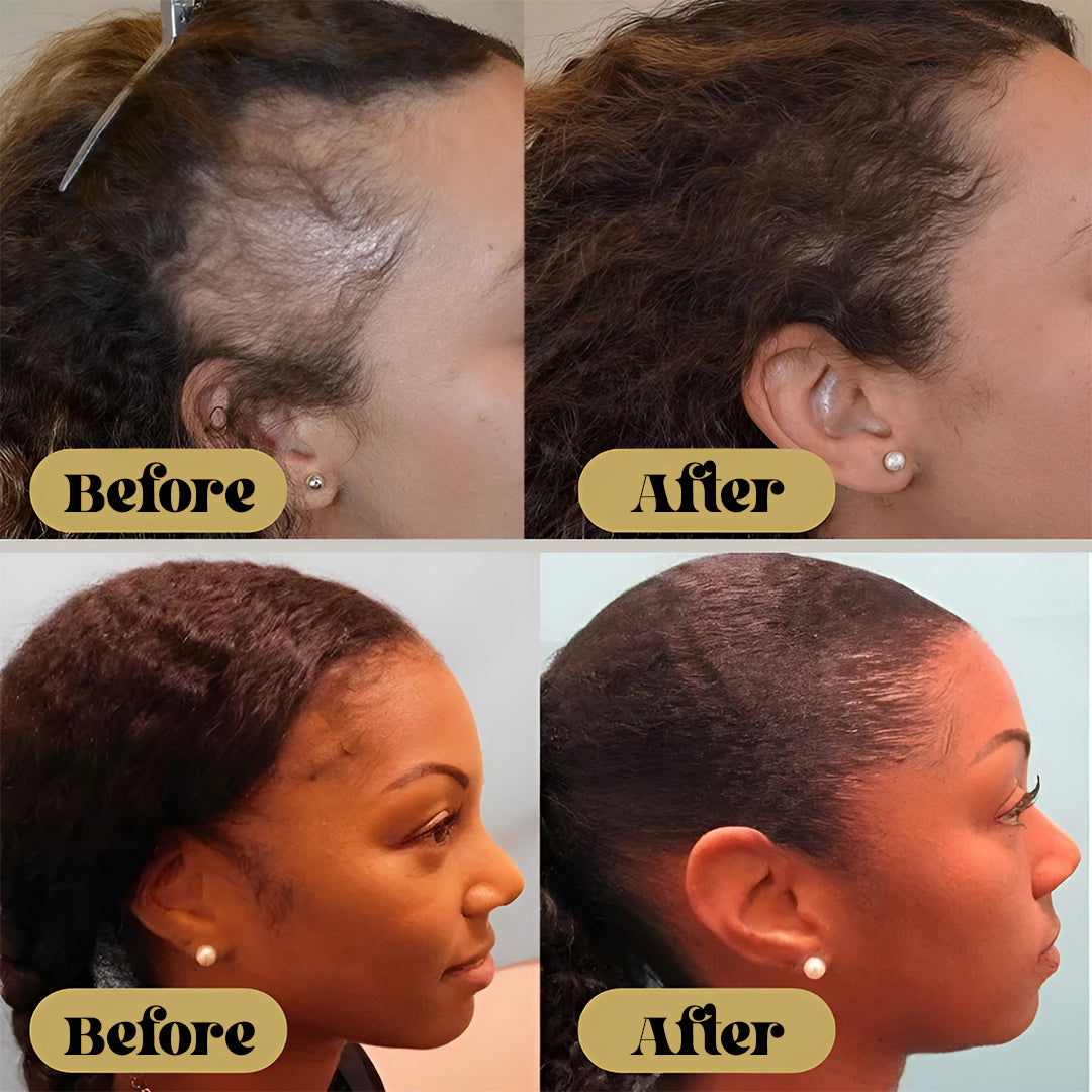 BareBloom™ Vegan Hair Growth Oil